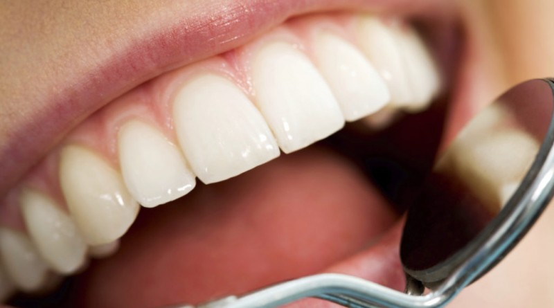 Во рту у семилетнего мальчика нашли 526 лишних зубов