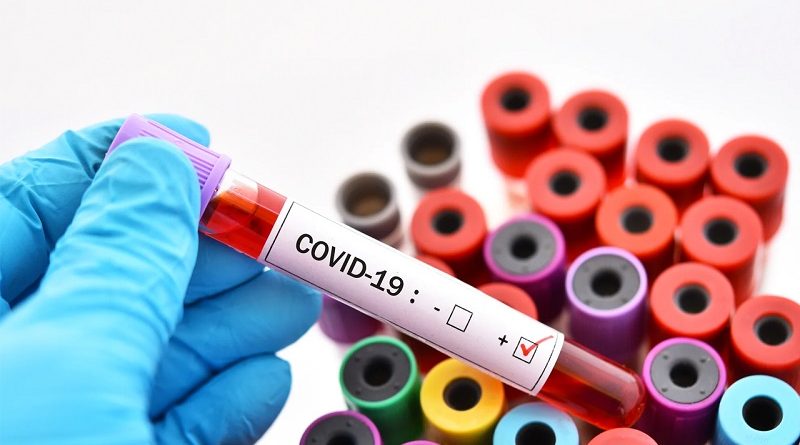 Коронавирус COVID-19 - проверенная информация